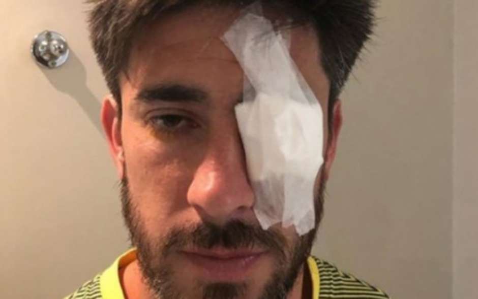 Раненият в окото при нападението капитан на "Бока Хуниорс" Пабло Перес. Снимка: Туитър
