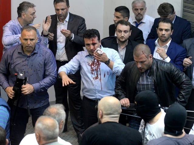Окървавеното лице на Зоран Заев бе по всички телевизионни екрани в четвъртък вечер. Най-отзад в бяла риза е Талат Джафери. Снимка: Anadolu Agency