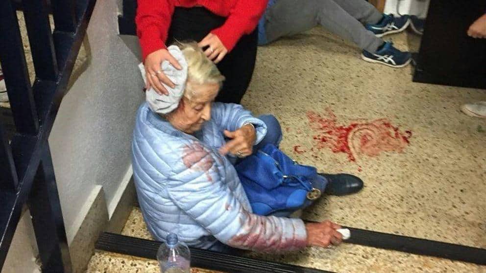 Главата на възрастна жена бе окървавена при полицейската акция в нейната секция. Снимка: Туитър