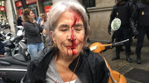 Окървавеният лик на тази жена, получила удар с полицейска палка на излизане от нейната изборна секция, обиколи световните медии. Снимка: La Vanguardia