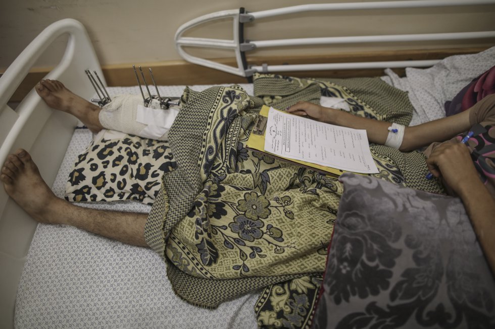 17-годишен палестинец от Ивицата Газа трябваше да отговори на въпросите от изпита си в края на учебната година от своето болнично легло в Шифа, където се възстановява след раняване в крака от шрапнел, получено по време на протести. Снимка: УНИЦЕФ