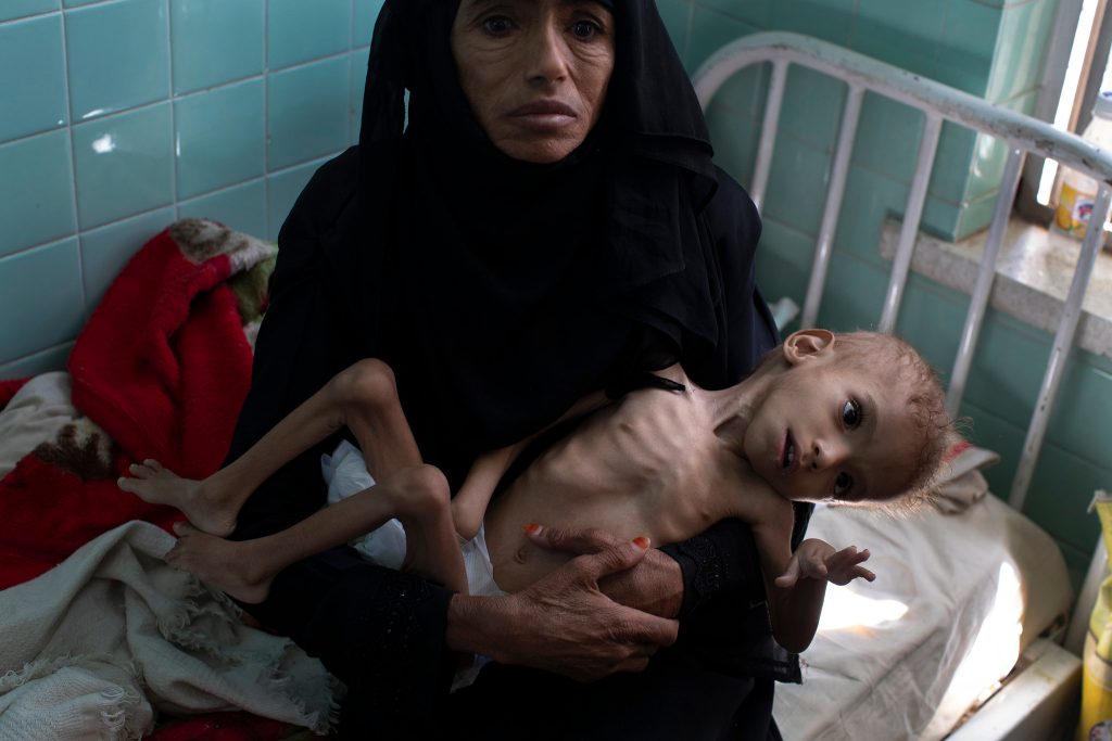 Поне 85 хил. деца са загинали от глад в Йемен през последните три години. Снимка: New York Times