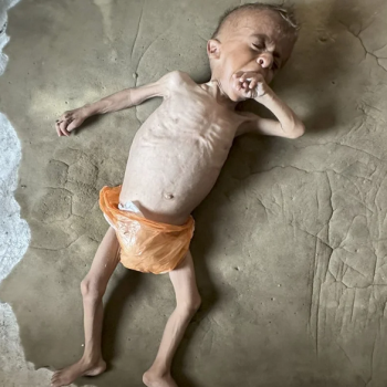 Screenshot 2025-08-02 at 18-00-17 'You can see his bones' In Gaza parents struggle against child starvation and Israeli war crimes denial Middle East Eye