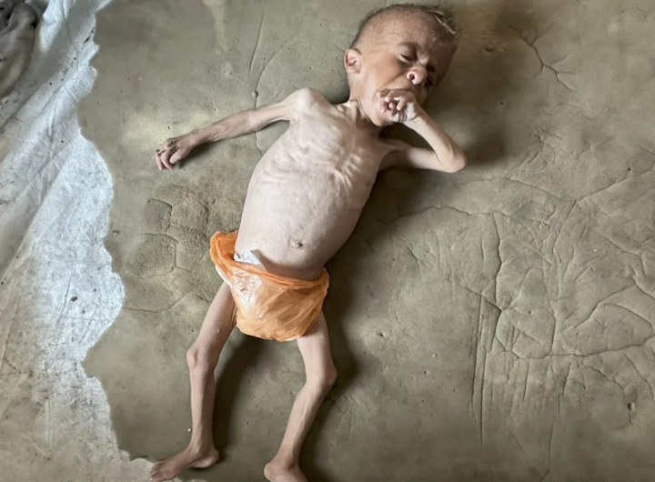 Screenshot 2025-08-02 at 18-00-17 'You can see his bones' In Gaza parents struggle against child starvation and Israeli war crimes denial Middle East Eye